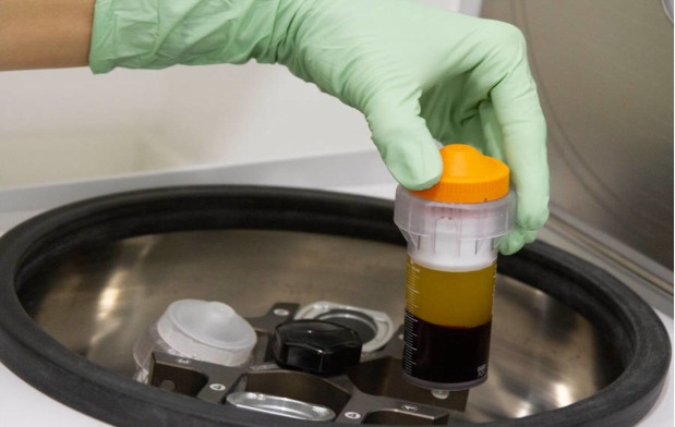 Plasma Rico en Plaquetas