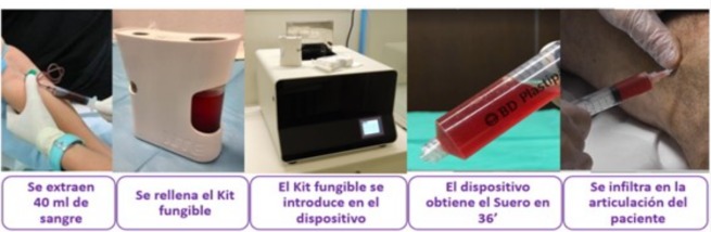 Plasma Rico en Citoquinas